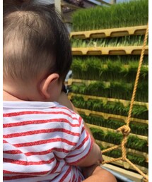 寝ハゲ😱 | その他