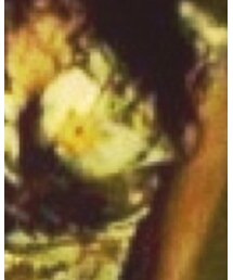 H&M | ワンピース