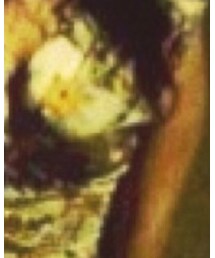 H&M | ワンピース