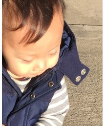 ほっぺが出過ぎ | その他