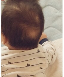 絶賛寝ハゲ中😂 | その他