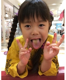 舌が黄色に | その他