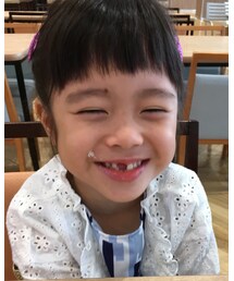 前歯抜けました🤣 | その他