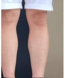 CIAOPANIC | アンクレット