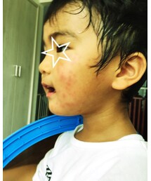 ぶつぶつ | その他