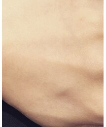 Antoanetta | リング