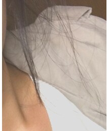 ZARA | トレンチコート