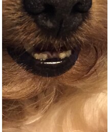 前歯抜けてます | その他