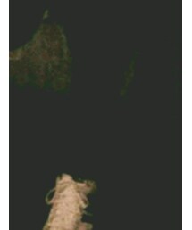 adidas | スニーカー