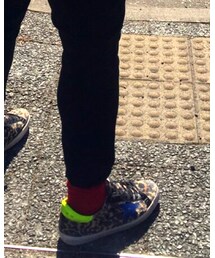 GOLDEN GOOSE | スニーカー