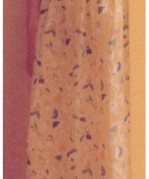 ehka sopo | ワンピース