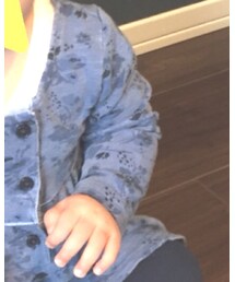 next | ワンピース