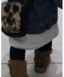 Champion | ワンピース