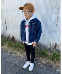 全身 | その他