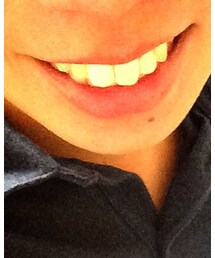 きたねぇ歯 | その他