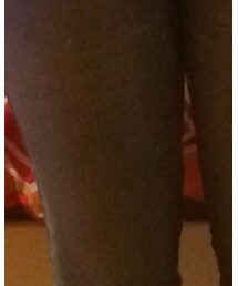 Hollister | デニムパンツ