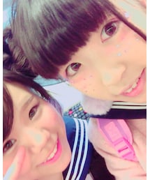 きらきらそばかす | その他