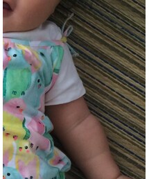 H&M | ロンパース