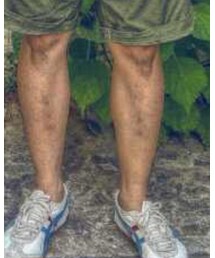 Onitsuka Tiger | スニーカー