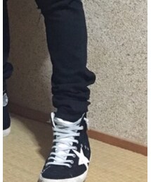 GOLDEN GOOSE | スニーカー