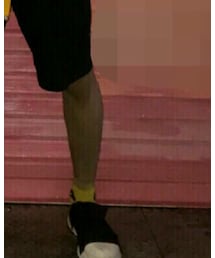 FESSURA | スニーカー