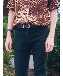 H&M | デニムパンツ