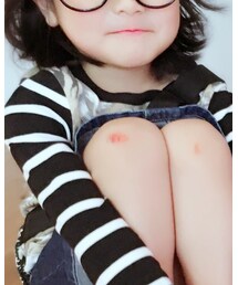 赤ちん | その他