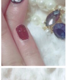 self nail🎀 | アクセサリー