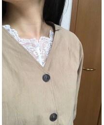 アップver. | その他