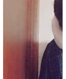 clette | チェスターコート