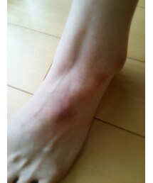 🚫 | これがホントの痛々しい(その他)