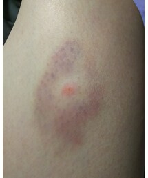 その他 | その他