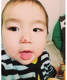 イテテしたよ | その他