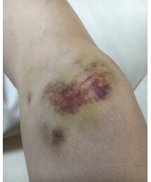 転んだ | その他