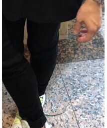 Acne Studios | その他パンツ