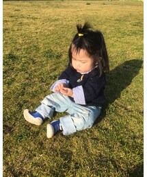 眉間のシワ | その他