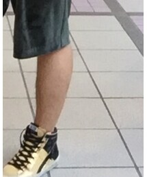 GOLDEN GOOSE | スニーカー