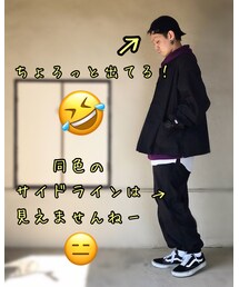 前髪が短いと、こうなりがち🤣 | その他