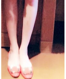 Roger Vivier | スリッポン