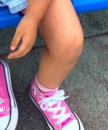 CONVERSE | スニーカー