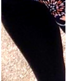 adidas | その他トップス