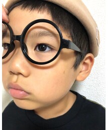 お目目ケガしました👀 | その他