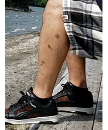 A BATHING APE | パンツ