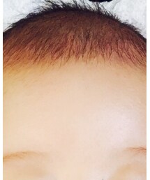 髪うすい | ママ＆ベビー