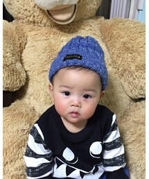 おめめ 治ってきたよーっ♡ | その他