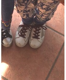 GOLDEN GOOSE | スニーカー