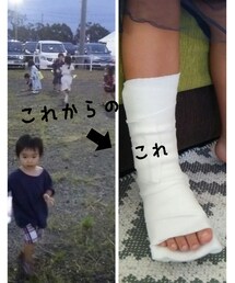 はしゃぎ回って負傷😨 | その他