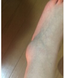 ぽっこり | シューズ