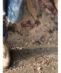 Levi's | デニムパンツ