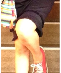 CONVERSE | スニーカー